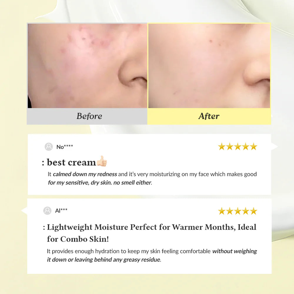 Dr.Althea 345 Relief Cream - Viral Korean Acne* Removing Cream - NeYavi