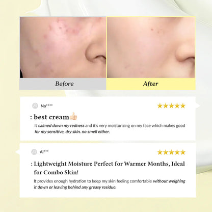 Dr.Althea 345 Relief Cream - Viral Korean Acne* Removing Cream