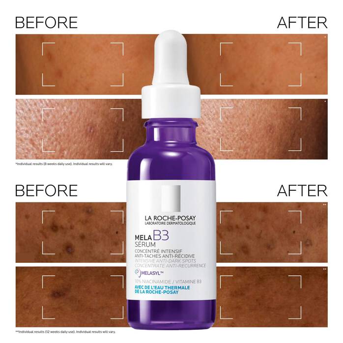 La Roche-Posay Mela B3 Dark Spot Serum With Melasyl™ + Niacinamide 30ml - NeYavi